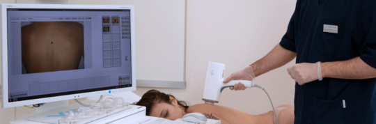 Melanoma e prevenzione: l’importanza della mappatura dei nei