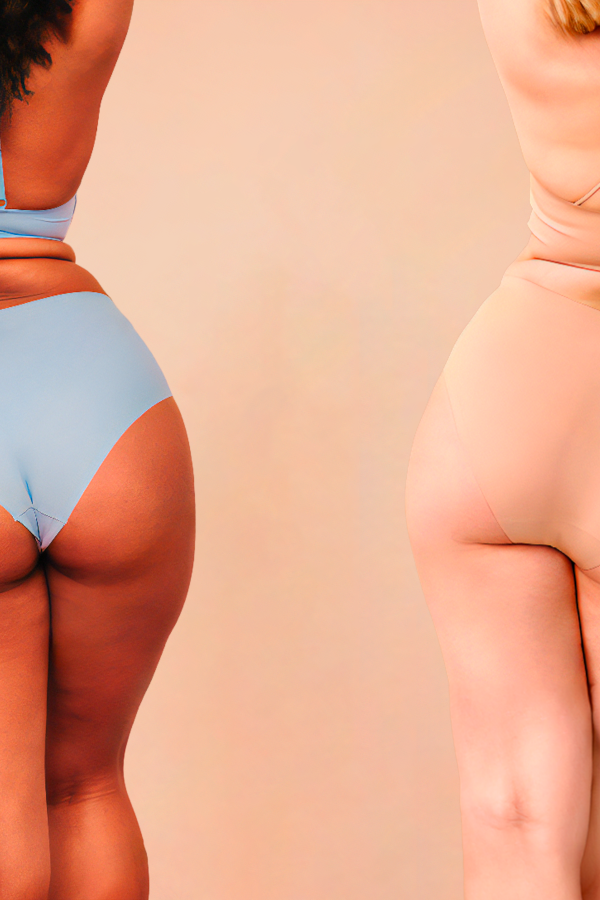 La cellulite: un nemico comune per molte donne